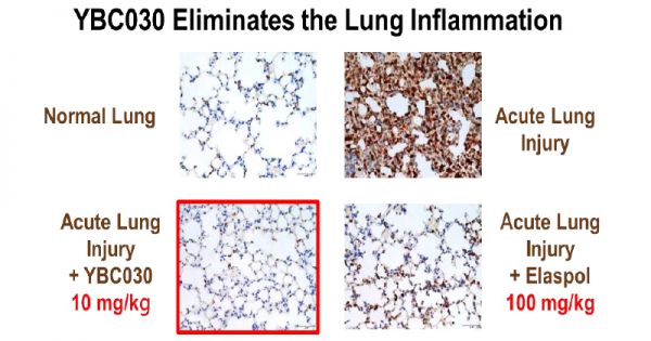 圖二、YBC030有效改善肺部發炎